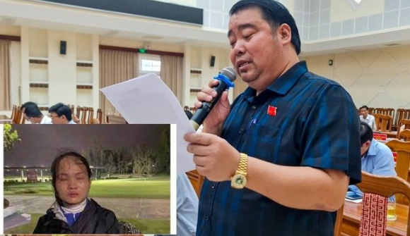 Ông Nguyễn Viết Dũng nói gậy golf chỉ “sượt qua nón” và dư luận đang “bới móc, vu khống”